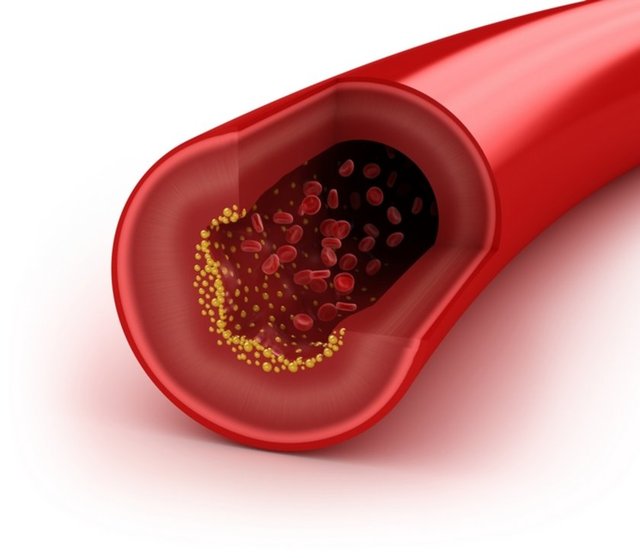 12. Toplam kolesterol değerim 5.2 mmol/litrenin altında.