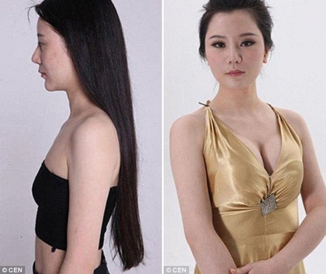 Julie karın bölgesi yağlarından kurtulmak için liposuction , göğüslerine silikon ve cilt tedavisi yaptırmıştır.