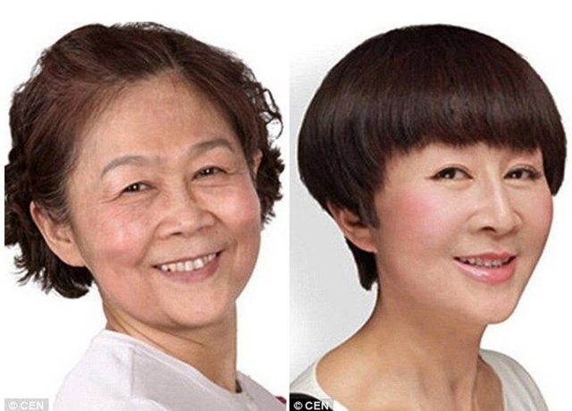 Burun ve botox yaptırmıştır.