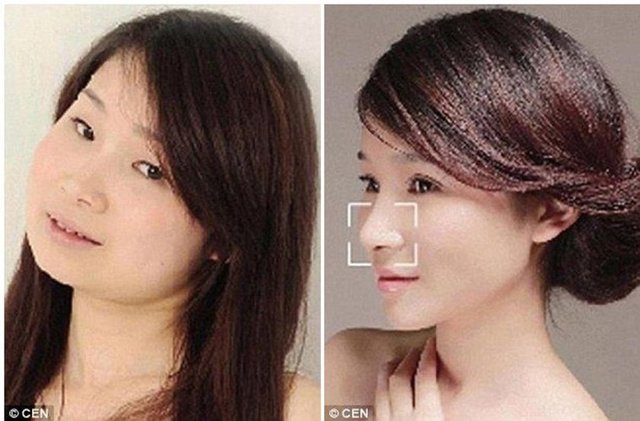 Anaokulu öğretmeni olan Xu Yan çene, burun ve botoks  uygulamaları yaptırdıktan sonra  böyle değişti.