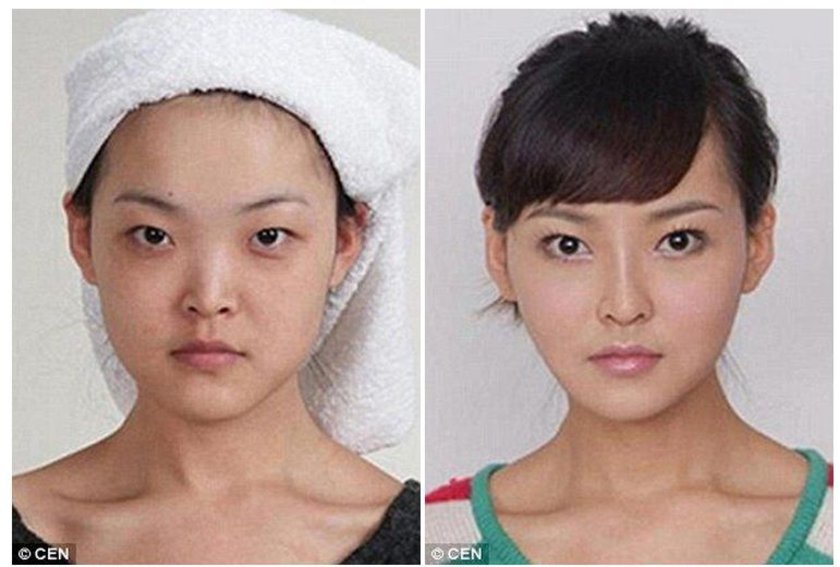 Изменить разрез глаза фото до и после