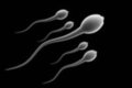 Semen analizi yaptırmak spermlerin hala sağlıklı olduğundan emin olmanın tek yoludur!