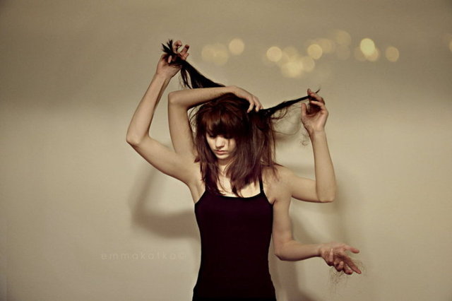 Trikotilomani rahatsızlığı olan kişiler, kendilerine saçlarını çekerek zarar vermek için karşı konulamaz bir istek duyuyor.