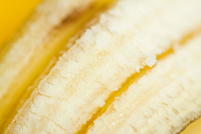 Sivrisinek ısırıkları:   Böcek ısırığı kremine ulaşmadan önce, ısırıktan etkilenen bölgeyi muz kabuğunun içiyle ovmayı deneyin.