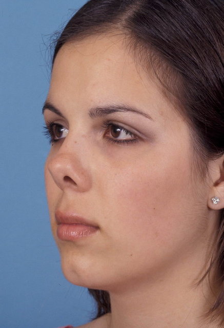 Kalkık Burun İyimser, sevgi dolu, destekleyici ve iyi karaktere sahip kişilerdir.