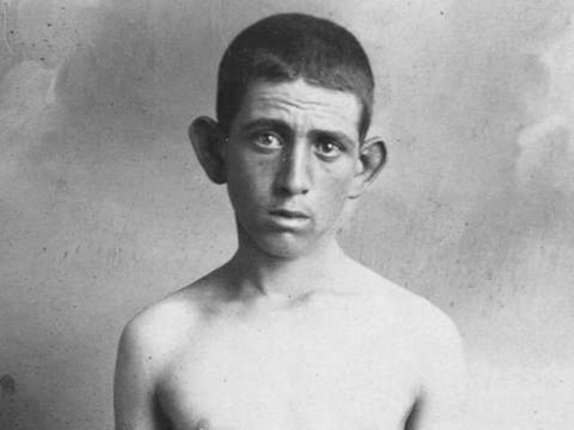 Büyük kulak Büyük kulağa sahipseniz özgür ruhlu ve cana yakınsınız.