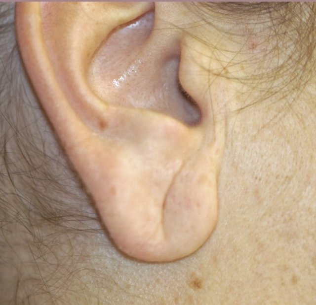 Büyük, Uzun kulak memesi Hayattan zevk almasını bilen şanslı insanlardır.