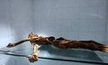 <p>Ötzi'nin ölümüne omzuna saplanan bir okun neden olduğu, ölümünden kısa süre önce keçi eti yediği belirlendi. Dişlerinin çürük olduğu ve kenelerin ısırmasıyla bulaşan lyme hastalığına yakalanmış olduğu tespit edildi. Vücudunun çeşitli yerlerinde dövme bulunan Ötzi'nin saç ve göz renginin kahverengi olduğunu, kan grubunun ise 0 (sıfır) olduğu ortaya çıkarıldı.</p>