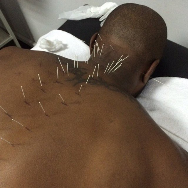 PASCAL NOUMA  - Fenayım, boynum tutuldu :(