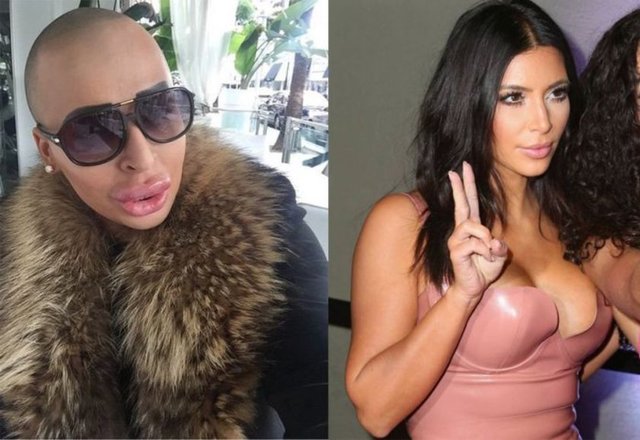 Kim Kardashian'a benzemek için bunu da yapacak Ünlü TV yıldızı Kim Kardashian'a hayran olan James Jordan Parke, ona benzemek için bir servet harcadı.