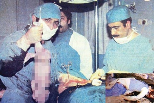 Esma Suna ve karnındaki bebeği kurşunlanarak öldürüldü.