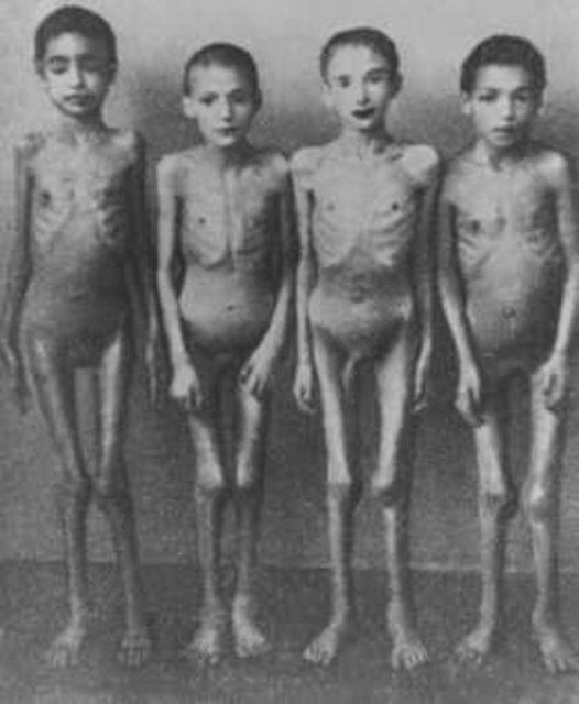 Ensizyon sonucu bacağın şekil değiştiren yaralarına tıbbî personel tarafından bilerek bakteri, pislik ve cam parçaları ile enfekte edildi. Auschwitz-Birkenau'da Dr. Josef Mengele'nin tıbbı deneylerde kullandığı kurbanlar.