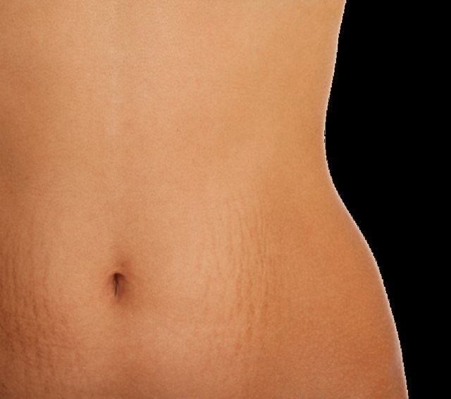 ÇATLAKLARDAN NASIL KURTULURUM? Kadınların çoğunun en büyük sorunlarından biri olan çatlaklar ve çözüm yolları, yine kadınların en çok ilgi duydukları konular arasında yer alıyor.