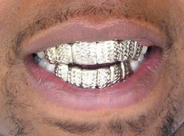 Platinyum 1 gramı: 58 dolar Platin bilimsel deneylerde katalizör olarak kullanılırken aynı zamanda takı malzemesi de olabilir. Bunun dışında kanser tedavisinde kullanılan ilaçlarda da bu maddeye rastlayabiliriz. -