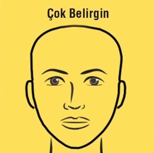 Çok Belirgin Alın: Hayal gücünün çok yoğun olduğunu gösterir.