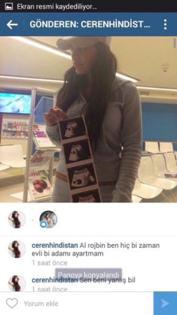 Hindistan da "Hamileyim" diyerek Rojbin Aslan'a ultrason kağıtlarını gönderip altına "Aramızdaki fark ne biliyor musun? Sen seni sevmeyen bir adamın peşinde koşuyorsun" yazdı. (MAKARON)