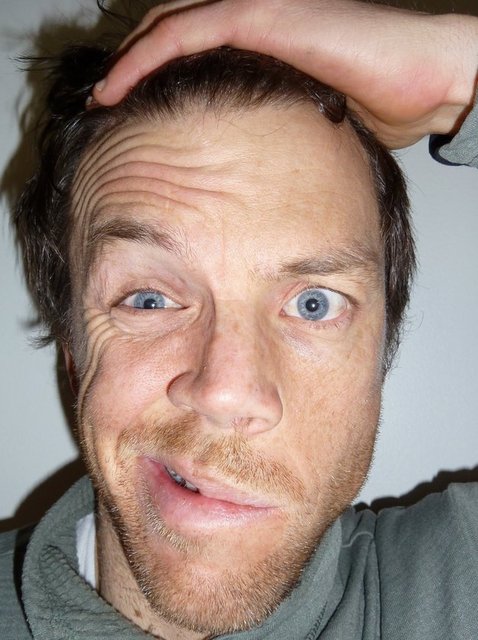 Yüzün  bir yarısındaki kaslar düşer veya zayıflar.