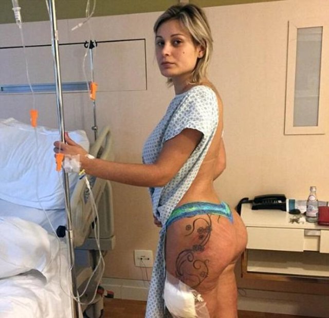 Model ve TV sunucusu Urach aralık ayında hastaneye yatmış ve tam 1 ayı yoğun bakımda geçirmişti.