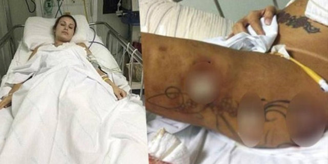 Hasta yatağından konuşan genç model, "Çok acı çekiyorum ama Tanrı benim yanımda. Tüm bu olanlar benim hatamdı, sınırları zorlamaya çalıştığım için oldu" demişti.