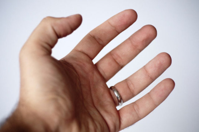 Ayrıca düzenli olarak bir bardak suda bir çay kaşığı amonyakla geceleri yüzüğünüzü temizleyin. Yüzüğünüzü takmadan çalkalayıp, kurulamayın. Yinede egzama başladığında bir cilt uzmanına mutlaka gitmelisiniz.