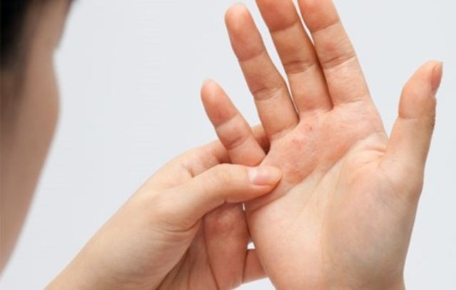 Dermatoloji Uzmanı Dr. - Şerafettin Saraçoğlu ise, sıcak ve soğuk değişiminin ani olarak yaşandığı bahar döneminde cildin yıprandığını söyleyerek şu uyarı ve önerlerde bulundu: -