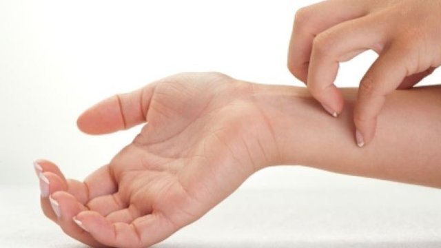 El egzaması hastalığının iyileşmesi birkaç ayı alabilir. İyileşme süresinde ve sonrasında ellerin egzama olmasını önlemek için bir takım kurallara uymak gerekir.