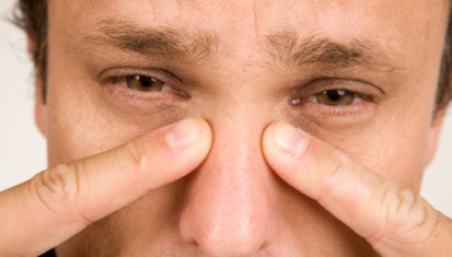 Yüzde şişme ve dolgunluk