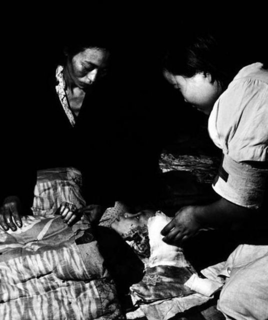 Patlamanın kurbanları çok kötü koşullarda tedavi edilmeye çalışılıyordu. Kangyo Ginko banka binası yaralılar için hastaneye dönüştürülmüştü. Çoğu kurban radyasyon yanığı ve şok yüzünden buradaydı.