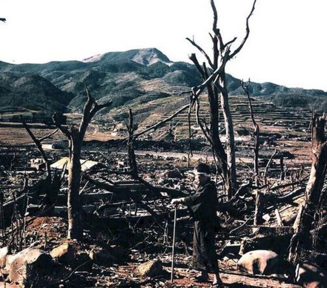 Fotoğraftaki kişi doktor ve X-ray uzmanı Dr. Nagai. Fotoğraf çekildikten sadece birkaç gün sonra radyasyondan dolayı o da yaşamını yitirdi.