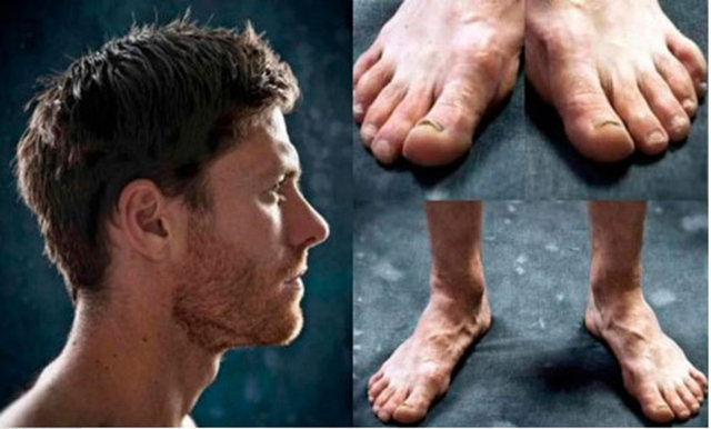 Xabi Alonso
