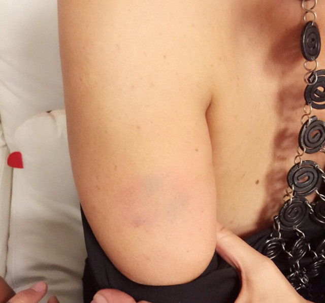 AYŞEGÜL ALDİNÇ  - Bu karede de Hülya'nın ısırılmak süretiyle coşkulu bir şekilde sevgisine mazhar olan kolum görülmekte -