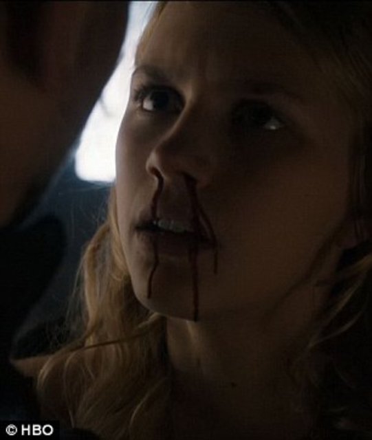 Myrcella Baratheon öldü mü?