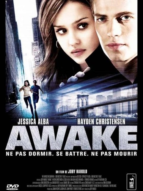 * Awake (Anestezi)