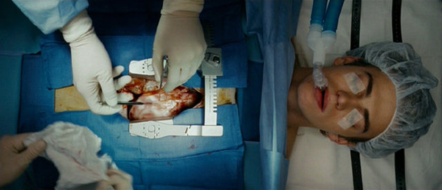 Ameliyatta olan her şeyi duyuyor ve bedeni kesilirken tüm acıyı hissediyor. Ancak anestezinin etkisiyle vücudu hiçbir şeye tepki gösteremez.