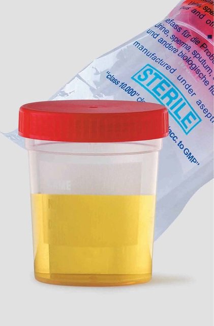 Ürofobi: İdrardan korkmak.