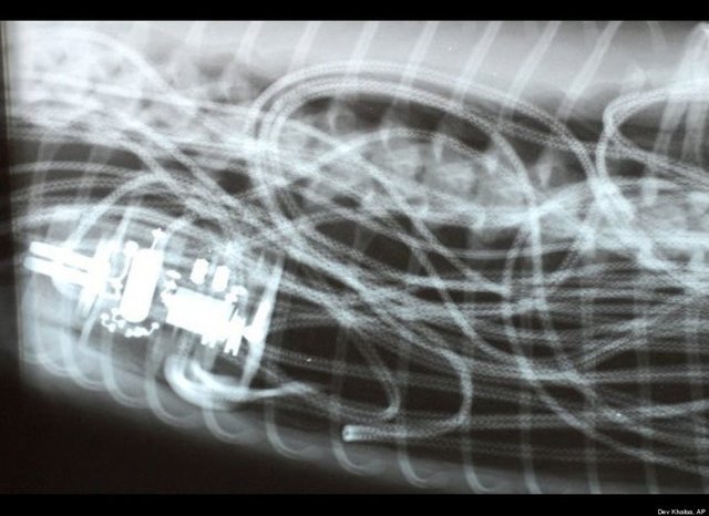 Isınması için kafesine elektrikli battaniye konulan piton, battaniyeyi yuttu.