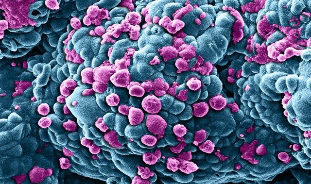 Kanserin, dünyada ve Türkiye'de en sık görülen ölüm nedenleri arasında olduğunu ifade eden Prof. Dr. Serdar Yol, kanserin ölüm nedeni olarak kalp damar hastalıklarından sonra ikinci sırada yer aldığını söyledi. -