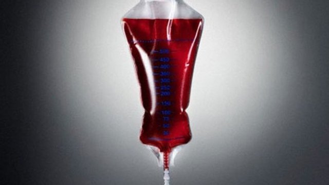 * Ameliyatlarda HIV testi (-) olduğundan emin olduğunuz kanın verilmesine dikkat edilmeli. -
