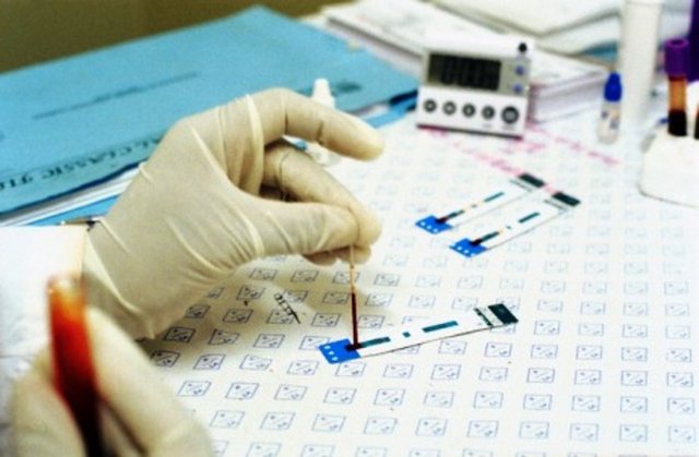 HIV infeksiyonunun saptanmasında kullanılan en güvenilir test ise ELİSA. Henüz kesin bir aşı ve tedavi geliştirilememiş olan, ölümle sonuçlanan ve gençler arasında büyük bir yayılım gösteren bu hastalıktan korunmanın tek yolu ise bilgi sahibi olmaktır.