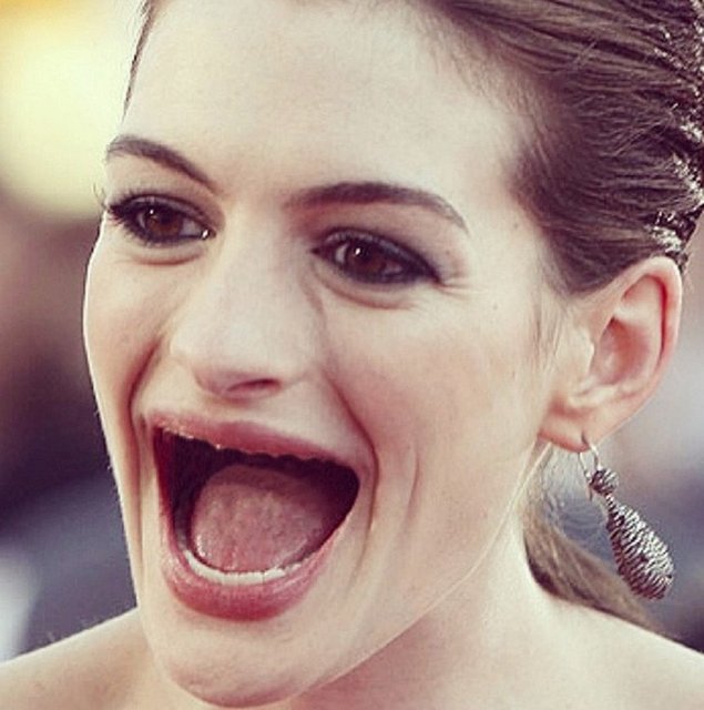 Anne Hathaway dişsiz hali -