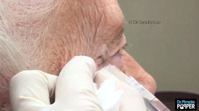 Yaşama sevinciyle dolu olan bu yaşlı kadın, "Önümüzdeki hafta partide güzel görünmek istiyorum" diye espriler yaptı.