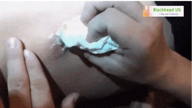 Bakmaya cesaret edemeyeceğiniz bu siyah nokta, sahibine oldukça acı veriyor.