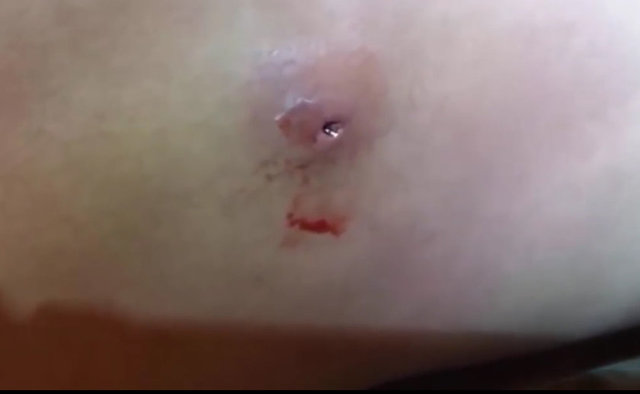 Çoğumuz zaman zaman bu sorunla karşı karşıya kalırız. Ama bu siyah nokta bir başka...