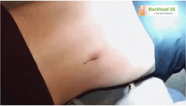 Sıkılmak üzere bekleyen bu siyah nokta sadece bir hamle bekliyor.