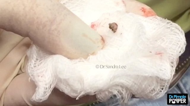 Aynı zamanda doktor, bu hastayla beraber onca vakit geçirmemize rağmen aslında gözümden böyle bir şey kaçmazdı ama..." dediği de gözlerden kaçmadı.