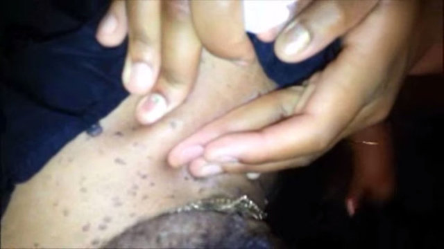 Yardımcının onları sıkarken "iğrenç" dediği gözlerden kaçmıyor.