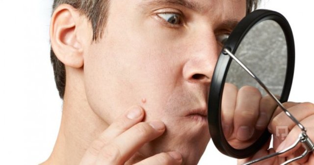 Kıl dönmesinin belirtileri arasında küçük kırmızı kabarıklıklar, içi iltihap dolu kabarıklıklar, deri renginde koyulaşma, ağrı ve kaşıntı bulunur" dedi.