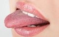 Dil kanserinin belirtileri!