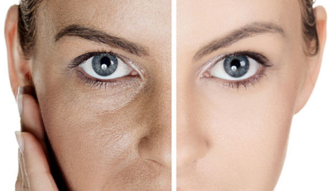 İşte cildinizdeki gözenekleri sıkılaştırıp, hayalinizdeki cilde kavuşmanız için evde hazırlayabileceğiniz pratik tarifler...