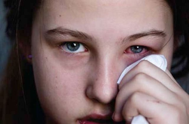 GÖZLÜĞE RAĞMEN GÖZ BOZUKLUĞU VARSA DİKKAT!